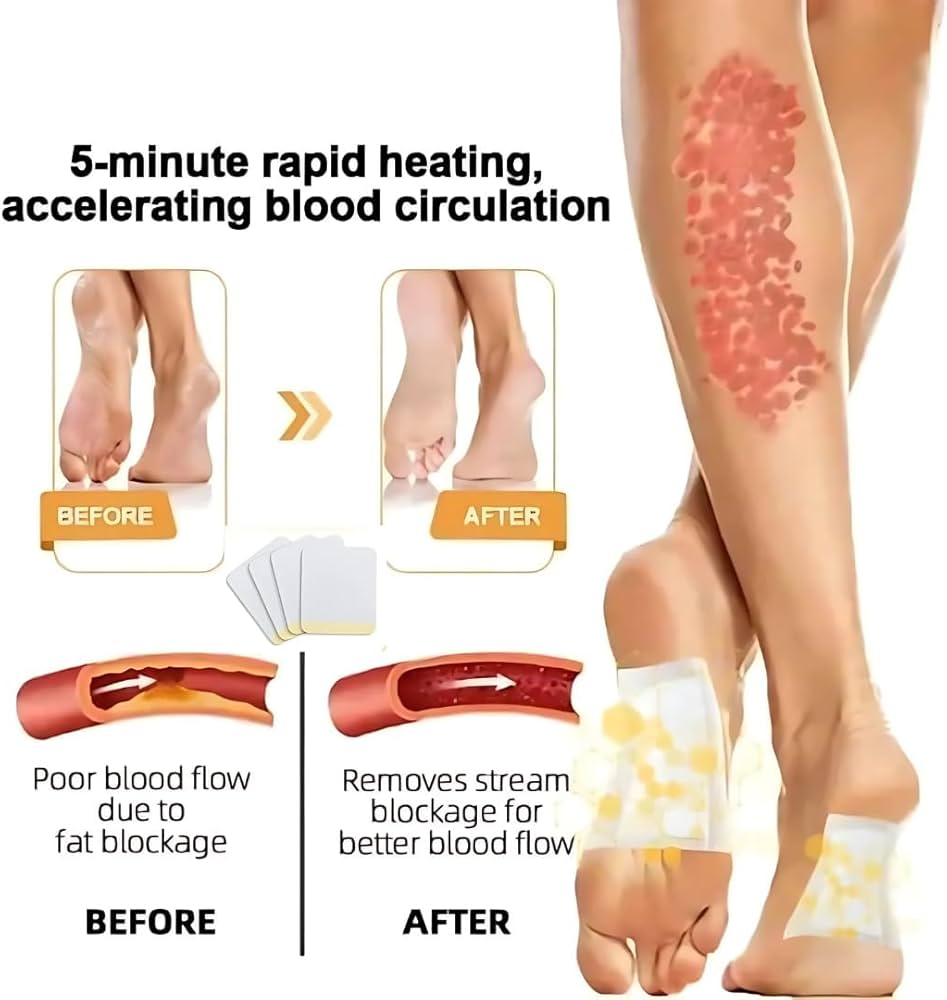 Bee Venom Lymphatic Drainage & Slimming Foot Patches(Set of 10 Patches) BUY 1 GET 1 FREE