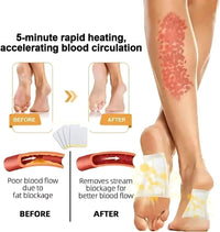 Bee Venom Lymphatic Drainage & Slimming Foot Patches(Set of 10 Patches) BUY 1 GET 1 FREE